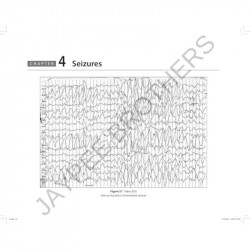 NEUROSCIENCE EEG ATLAS book by Nundy Amitabh - Additional Image 7