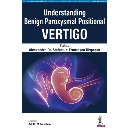 UNDERSTANDING BENIGN PAROXYSMAL POSITIONAL VERTIGO book by Alessandro De Stefano, Francesco Dispenza