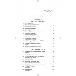 RAMAMURTHI & TANDON'S MANUAL OF NEUROSURGERY (2 VOLS) book by Tandon Prakash Narain - Additional Image 3
