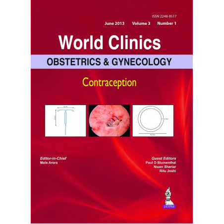WORLD CLINICS OBSTETRICS & GYNECOLOGY CONTRACEPTION JUNE 2013 (VOL.3, NO.1) book by Arora Mala