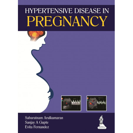 HYPERTENSIVE DISEASE IN PREGNANCY book by Arulkumaran Sabaratnam