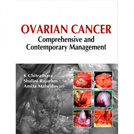 OVARIAN CANCER COMPREHENSIVE AND CONTEMPORARY MANAGEMENT book by Deshpande