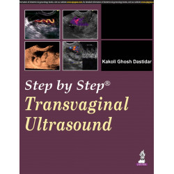 Step by Step Transvaginal Ultrasound with CD-ROM book by Dastidar
