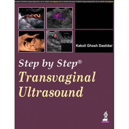 Step by Step Transvaginal Ultrasound with CD-ROM book by Dastidar