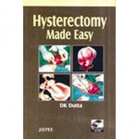 Hysterectomy Made Easy with CD-ROM book by Dutta