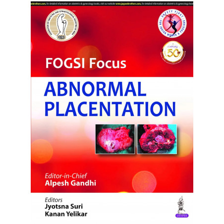 FOGSI Focus Abnormal Placentation book by Gandhi Alpesh