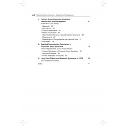 Infertility Management Series: Polycystic Ovarion Syndrome (Diagnosis and Management) book by Richa Jagtap, Manish Banker - Addi