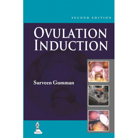 STEP BY STEP OVULATION INDUCTION WITH CD-ROM book by Surveen Ghumman