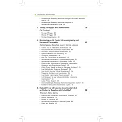 INFERTILITY MANAGEMENT SERIES:INTRAUTERINE INSEMINATION book by Garcia-Velasco Juan A - Additional Image 7