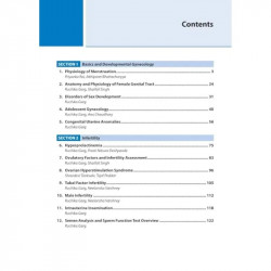 Ready Reckoner in Gynecology: Exam-Oriented Handbook for OBG Postgraduates and MBBS Students | Complete Syllabus Coverage wi… -
