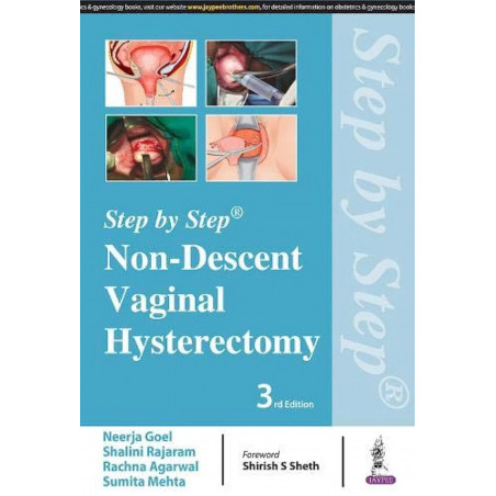 STEP BY STEP NON-DESCENT VAGINAL HYSTERECTOMY book by Neerja Goel, Shalini Rajaram