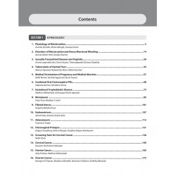 Solved Papers Obstetrics & Gynecology for PG Students: A Must for MS/MD/DNB OBG | Past 10 Years Solved Questions (PYQs) with… -