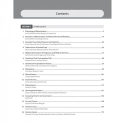 Solved Papers Obstetrics & Gynecology for PG Students: A Must for MS/MD/DNB OBG | Past 10 Years Solved Questions (PYQs) with… -