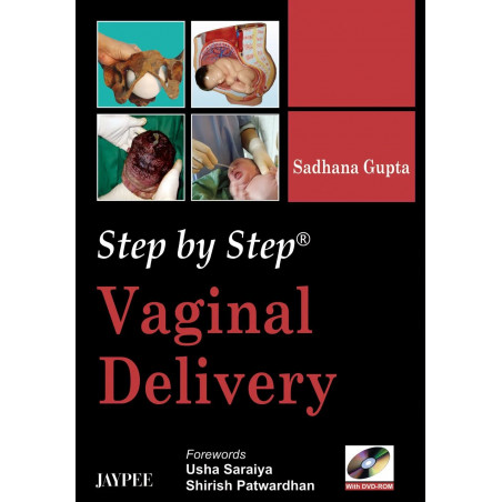 Step by Step Vaginal Delivery with DVD-ROM book by Gupta Sadhana