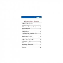 COLOR ATLAS OF PATHOLOGICAL SPECIMENS & INSTRUMENTS IN OBSTETRICS & GYNECOLOGY book by Inamadar - Additional Image 3