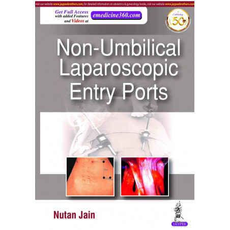NON-UMBILICAL LAPAROSCOPIC ENTRY PORTS book by Nutan Jain