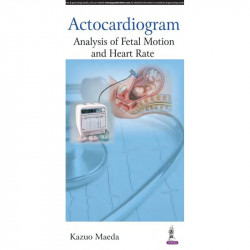 ACTOCARDIOGRAM:ANALYSIS OF FETAL MOTION AND HEART RATE book by Maeda Kazuo