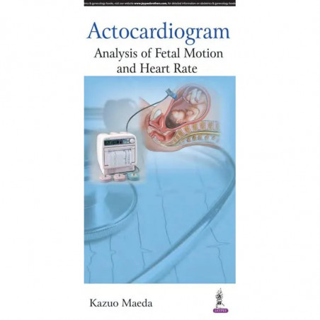 ACTOCARDIOGRAM:ANALYSIS OF FETAL MOTION AND HEART RATE book by Maeda Kazuo