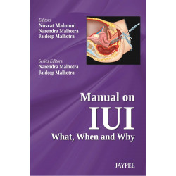 Manual on IUI What, When and Why book by Mahmud Nusrat