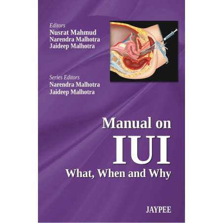 Manual on IUI What, When and Why book by Mahmud Nusrat