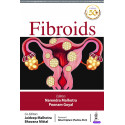 FIBROIDS book by Narendra Malhotra, Poonam Goyal