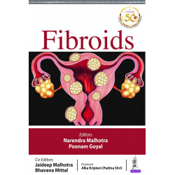 FIBROIDS book by Narendra Malhotra, Poonam Goyal