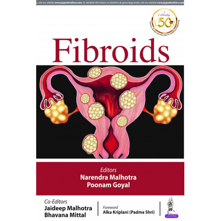 FIBROIDS book by Narendra Malhotra, Poonam Goyal