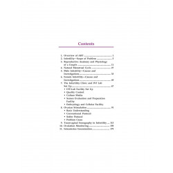 STEP BY STEP ASSISTED REPRODUCTIVE TECHNOLOGY(ART) WITH 2 INT.DVD-ROMS DR.MALHOTRA SERIES book by Malhotra - Back Cover