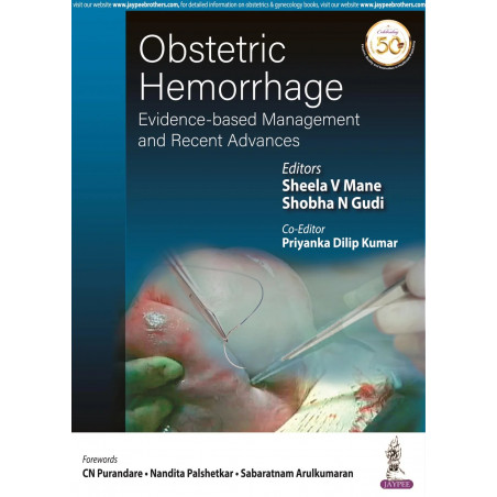 OBSTETRIC HEMORRHAGE: EVIDENCE-BASED MANAGEMENT AND RECENT ADVANCES book by Sheela Mane, Shobha N. Gudi