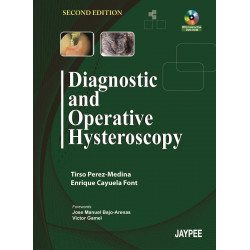 Diagnostic & Operative Hysteroscopy (POD) book by Perez-Medina
