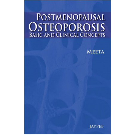 Postmenopausal Osteoporosis: Basic and Clinical Concepts book by Meeta