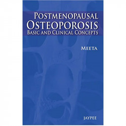 Postmenopausal Osteoporosis: Basic and Clinical Concepts book by Meeta - Back Cover