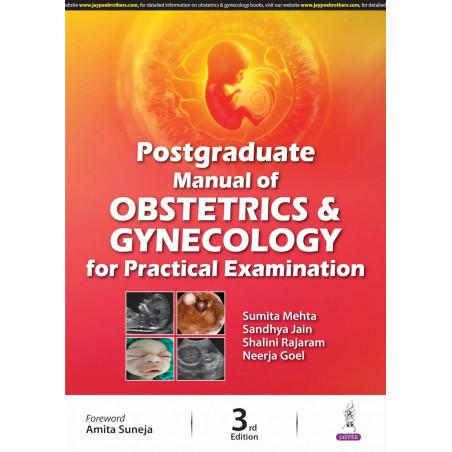 POSTGRADUATE MANUAL OF OBSTETRICS & GYNECOLOGY FOR PRACTICAL EXAMINATION book by Sumita Mehta, Sandhya Jain