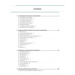 PRACTICAL GUIDE TO INTRAUTERINE INSEMINATION (IUI) book by Chaitanya Nagori, Sonal Panchal - Additional Image 5