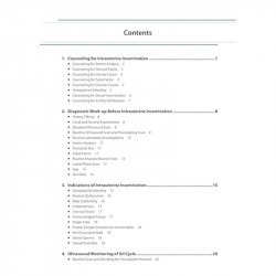 PRACTICAL GUIDE TO INTRAUTERINE INSEMINATION (IUI) book by Chaitanya Nagori, Sonal Panchal - Additional Image 6