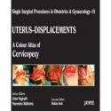 UTERUS-DISPLACEMENTS-15,A.C.A OF CERVICOPEXY :SINGLE SURGICAL PROCEDURES IN OBS &GYNE book