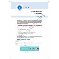 MANUAL ON HYSTEROSCOPY (AICOG 2025) book by Nandita Palshetkar, Hrishikesh D Pai - Additional Image 7