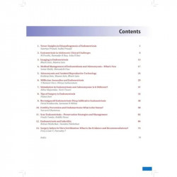 FOGSI Focus Endometriosis Current Trends (POD) book by Nandita Palshetkar - Additional Image 6