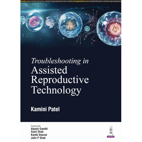 TROUBLESHOOTING IN ASSISTED REPRODUCTIVE TECHNOLOGY book by Kamini Patel