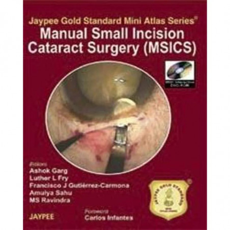 MANUAL SMALL INCISION CATARACT SURGERY (MSICS) WITH DVD-ROM JAYPEE GOLD STANDARD MINIATLAS book by Garg