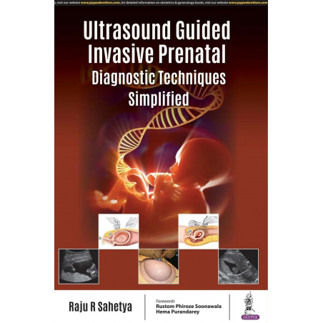 ULTRASOUND GUIDED INVASIVE PRENATAL DIAGNOSTIC TECHNIQUES SIMPLIFIED book by Raju R Sahetya