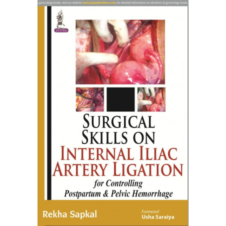 SURGICAL SKILLS ON INTERNAL ILIAC ARTERY LIGATION:FOR CONTROLLING POSTPARTUM & PELVIC HEMORRHAGE book by Sapkal Rekha