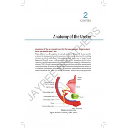 Simplified Laparoscopic Hysterectomy: Practical, Safe and Economic Methodology book by Rajendra S Sankpal, Mahantesh Karoshi - A