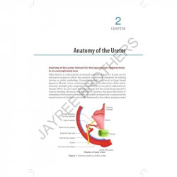 Simplified Laparoscopic Hysterectomy: Practical, Safe and Economic Methodology book by Rajendra S Sankpal, Mahantesh Karoshi - A