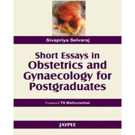 Short Essays in Obstetrics and Gynaecology for Postgraduates book by Kumar