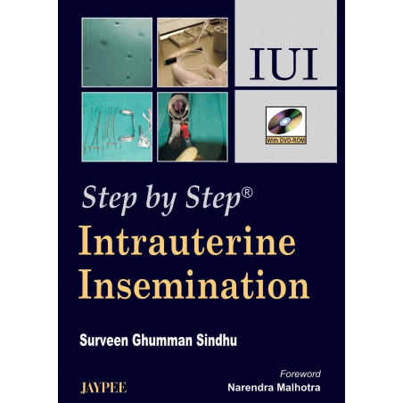 STEP BY STEP INTRAUTERINE INSEMINATION IUI WITH DVD-ROM book by Surveen Ghumman Sindhu