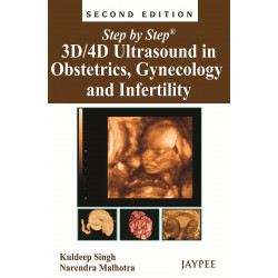 Step by Step 3D/4D in Ultrasound in Obstetrics, Gynecology and Infertility with Photo CD-ROM (POD) book by Kuldeep Singh