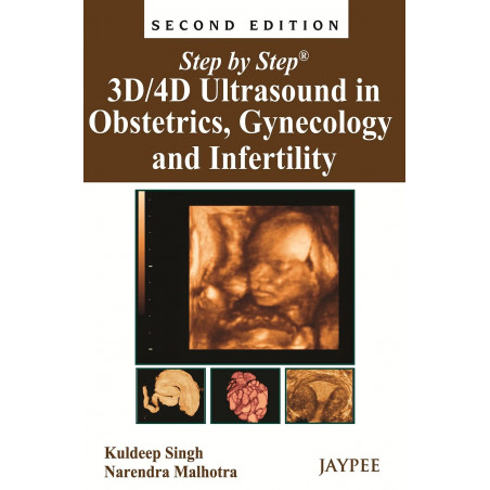 Step by Step 3D/4D in Ultrasound in Obstetrics, Gynecology and Infertility with Photo CD-ROM (POD) book by Kuldeep Singh