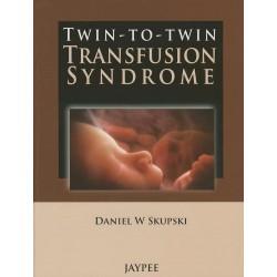 TWIN-TO-TWIN TRANSFUSION SYNDROME book by Skupski