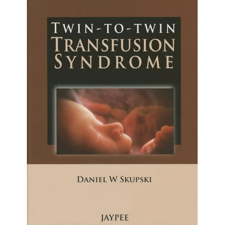 TWIN-TO-TWIN TRANSFUSION SYNDROME book by Skupski